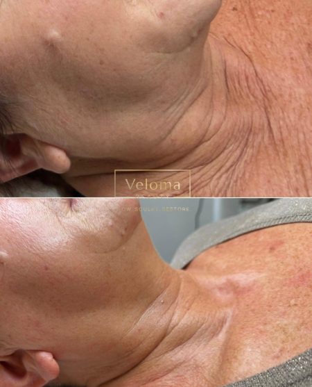 Veloma_300426_8 (2)